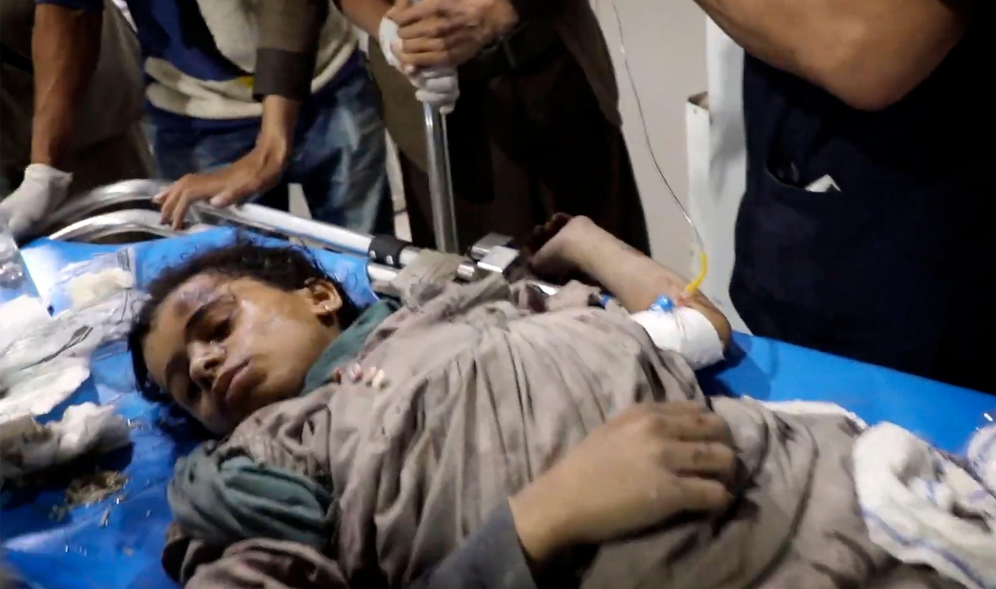 In this photo taken from video released by Ansar Allah Media Office via Al Masirah TV channel shows a wounded child being taken for treatment at a hospital in Saada, Yemen, Saturday, March 15, 2025 following airstrikes over multiple targets in the country. The Houthi-run Health Ministry said the overnight strikes killed at least 31 people, including women and children, and wounded over 100 in the capital of Sanaa and the northern province of Saada, the rebels' stronghold on the border with Saudi Arabia.( Al Masirah TV via AP)