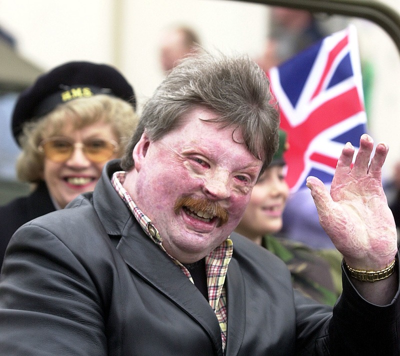 British soldier Simon Weston.